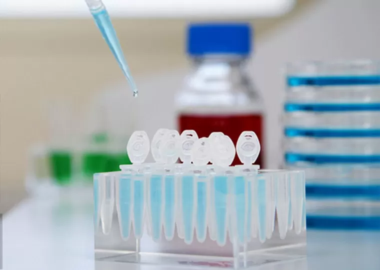 Schermo della materia prima