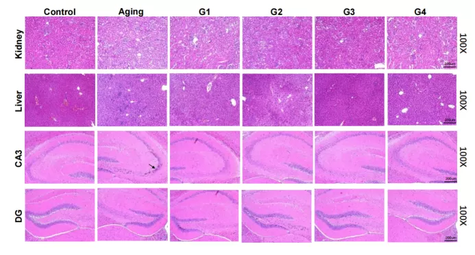 risultati interessanti nel modello di invecchiamento naturale