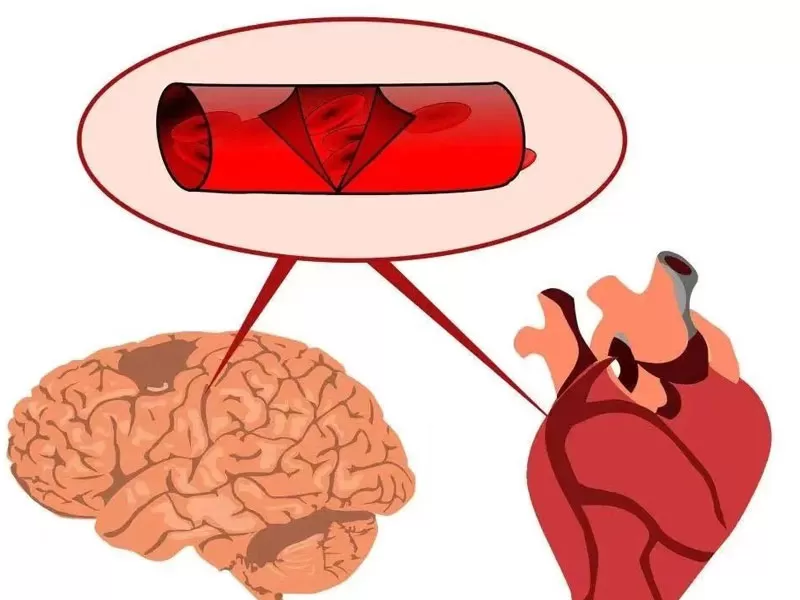 Serie Anti-età: resveratrolo