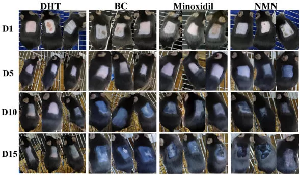 NMN e crescita dei capelli: nuove prove nell'alopecia androgenetica (AGA)